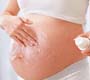 Zika vírus: medidas de prevenção para as gestantes