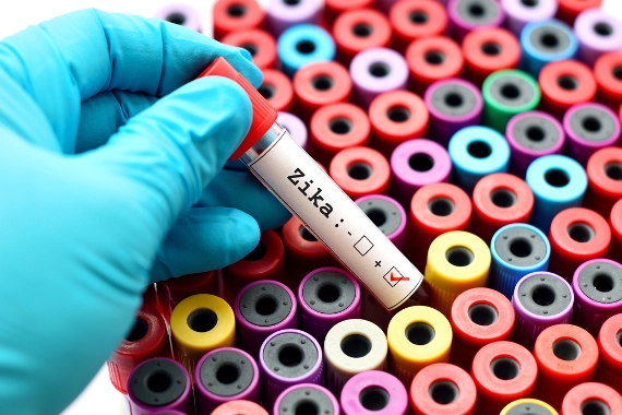 Especialistas se reúnem para discutir pesquisas sobre vírus Zika