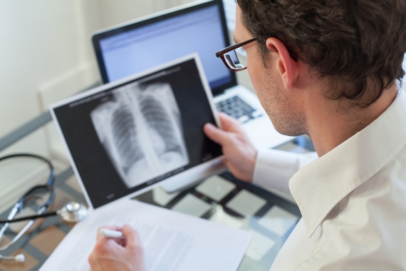 Tuberculose: estratégias para o controle das doenças transmissíveis em populações de maior vulnerabilidade
