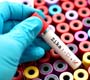 Especialistas se reúnem para discutir pesquisas sobre vírus Zika