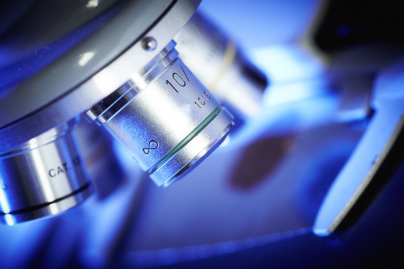 Laboratórios vão ampliar em 20 vezes a capacidade para testes de Zika 
