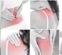 Fibromialgia: entenda mais desta doença silenciosa