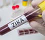 Anvisa concede registro a teste que detecta zika em até 20 minutos
